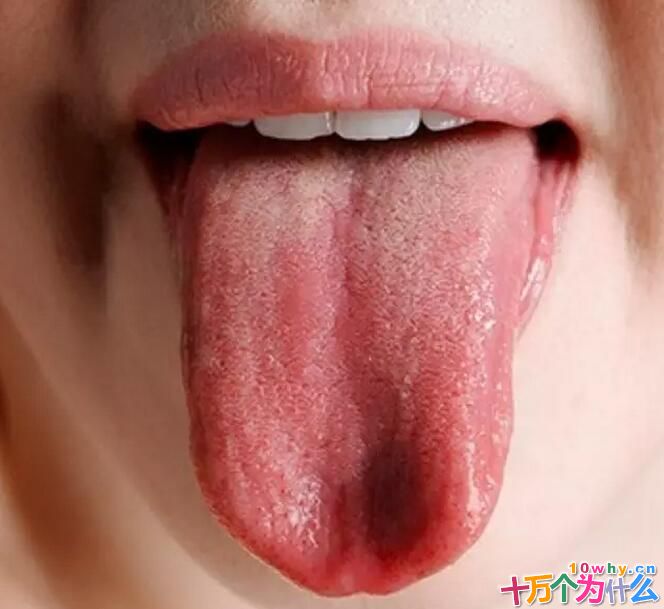 用舌头也可以“看”东西吗